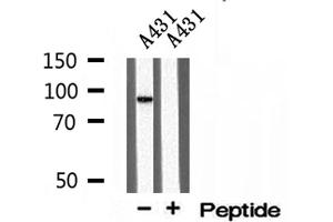 Western blot analysis of extracts of A431 cells, using TELO2 antibody. (TELO2 anticorps  (Internal Region))