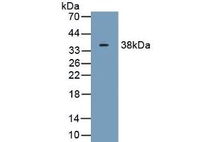Detection of Recombinant C1qB, Human using Polyclonal Antibody to Complement Component 1, Q Subcomponent B (C1qB)