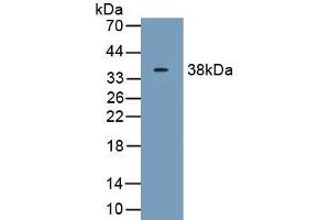 Detection of Recombinant C1qB, Human using Polyclonal Antibody to Complement Component 1, Q Subcomponent B (C1qB) (C1QB anticorps  (AA 28-253))
