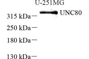 Western blot analysis of UNC80 (ABIN7076151),at dilution of 1: 2000 (UNC80 anticorps)