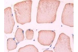 Detection of NOSTRIN in Rat Skeletal muscle Tissue using Polyclonal Antibody to Nitric Oxide Synthase Trafficker (NOSTRIN)