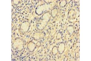 Immunohistochemistry of paraffin-embedded human stomach tissue using ABIN7175533 at dilution of 1:100 (VKORC1L1 anticorps  (AA 38-91))