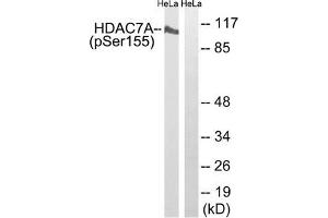 Western blot analysis of extracts from HeLa cells using HDAC7A (Phospho-Ser155) Antibody. (HDAC7 anticorps  (pSer155))
