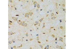 Immunohistochemistry of paraffin-embedded Rat brain using SRP19 Polyclonal Antibody at dilution of 1:100 (40x lens). (SRP19 anticorps)