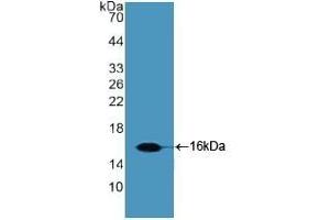 Detection of Recombinant Slit2, Human using Polyclonal Antibody to Slit Homolog 2 (Slit2)