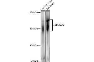 Western blot analysis of extracts of various cell lines, using SLC12 antibody (ABIN6131136, ABIN6147843, ABIN6147844 and ABIN6215366) at 1:500 dilution.