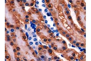 DAB staining on IHC-P; Samples: Rat Kidney Tissue (Glutathione Synthetase anticorps  (AA 270-474))