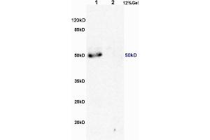 L1 human colon carcinoma lysates L2 rat brain lysates probed with Anti MSR1/CD204 Polyclonal Antibody, Unconjugated (ABIN872905) at 1:200 overnight at 4 °C.