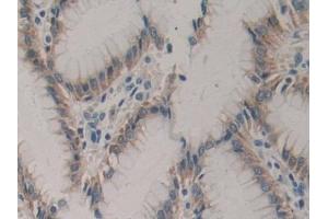 DAB staining on IHC-P; Samples: Human Stomach Tissue (CSF2RA anticorps  (AA 204-360))