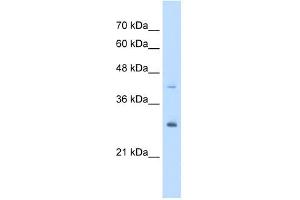 CACYBP antibody used at 5 ug/ml to detect target protein. (CACYBP anticorps  (Middle Region))