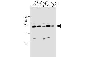 All lanes : Anti-SCXA Antibody (C-term) at 1:1000 dilution Lane 1: HACAT whole cell lysate Lane 2: U-2OS whole cell lysate Lane 3: MCF-7 whole cell lysate Lane 4: T47D whole cell lysate Lane 5: PC-3 whole cell lysate Lysates/proteins at 20 μg per lane.