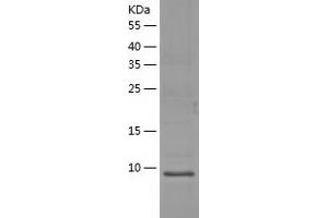 Western Blotting (WB) image for Musculoskeletal, Embryonic Nuclear Protein 1 (MUSTN1) (AA 1-82) protein (His-IF2DI Tag) (ABIN7124033)