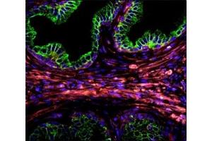 Confocal immunofluorescent analysis of Cytokeratin-18 antibody with prostate carcinoma followed by Alexa Fluor 488-conjugated goat anti-rabbit lgG (green).