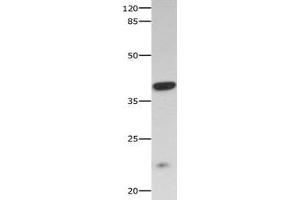 Gel: 10 % SDS-PAGE Lysate: 40 μg Mouse skeletal muscle tissue lysate Primary antibody: 1/300 dilution Secondary antibody: Goat anti Rabbit IgG - H&L (HRP) at 1/10000 dilution Exposure time: 60 seconds (CNTF Receptor alpha anticorps  (AA 23-342))