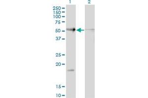 Western Blot analysis of RAD23B expression in transfected 293T cell line by RAD23B monoclonal antibody (M10), clone 3H7. (RAD23B anticorps  (AA 311-409))