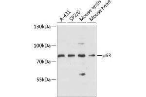 Western blot analysis of extracts of various cell lines, using p63 antibody (ABIN6133471, ABIN6149424, ABIN6149427 and ABIN6216755) at 1:3000 dilution. (p63 anticorps  (AA 1-160))