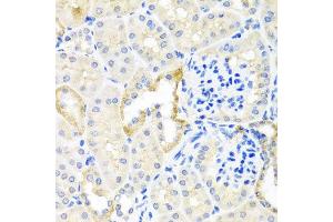 Immunohistochemistry of paraffin-embedded mouse kidney using TDGF1 antibody at dilution of 1:100 (x40 lens). (TDGF1 anticorps)