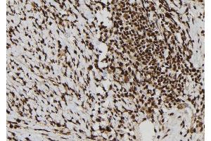 ABIN6277792 at 1/100 staining Human gastric tissue by IHC-P. (Calretinin anticorps  (C-Term))