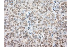 Immunohistochemical staining of paraffin-embedded Human colon tissue using anti-PDE4A mouse monoclonal antibody. (PDE4A anticorps)
