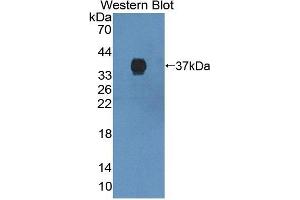 Detection of Recombinant ABCG2, Mouse using Polyclonal Antibody to ATP Binding Cassette Transporter G2 (ABCG2) (ABCG2 anticorps  (AA 63-349))