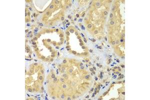 Immunohistochemistry of paraffin-embedded human kidney using CIAO1 antibody (ABIN5975509) at dilution of 1/100 (40x lens). (CIAO1 anticorps)
