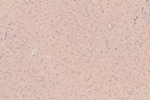 Immunohistochemistry analysis of paraffin-embedded rat hippocampus using,KIF5B (ABIN7074440) at dilution of 1: 1000