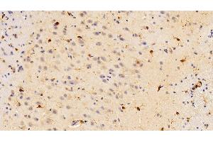 Detection of IBA1 in Rat Cerebrum Tissue using Polyclonal Antibody to Ionized Calcium-binding Adapter Molecule 1 (IBA1)