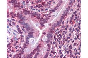 Anti-CACNG5 antibody IHC of human small intestine.