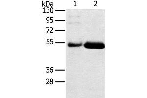Western Blot analysis of Human placenta and stomach cancer tissue using SAMD3 Polyclonal Antibody at dilution of 1:400 (SAMD3 anticorps)