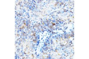 Immunohistochemistry of paraffin-embedded mouse spleen using ULBP1 Rabbit pAb (ABIN6128898, ABIN6149917, ABIN6149918 and ABIN6214755) at dilution of 1:500 (40x lens). (ULBP1 anticorps  (AA 26-216))