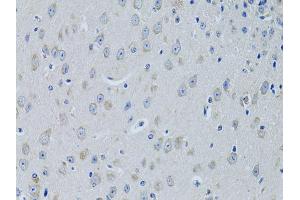 Immunohistochemistry of paraffin-embedded mouse brain using FDFT1 antibody (ABIN5973667) at dilution of 1/100 (40x lens). (FDFT1 anticorps)