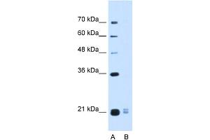 WB Suggested Anti-PLAC1L Antibody Titration:  0. (PLAC1L anticorps  (Middle Region))