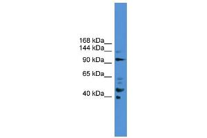 WB Suggested Anti-PIBF1  Antibody Titration: 0. (PIBF1 anticorps  (C-Term))