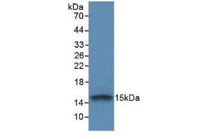 Western blot analysis of recombinant Human FGFR1.