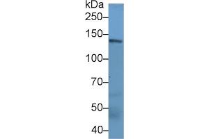 Detection of NEF3 in Rat Cerebrum lysate using Polyclonal Antibody to Neurofilament 3 (NEF3)