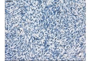 Immunohistochemical staining of paraffin-embedded Ovary tissue using anti-BCKDK mouse monoclonal antibody. (BCKDK anticorps)
