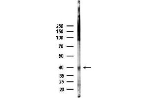 anti-Mitogen-Activated Protein Kinase Kinase 1/2 (MAP2K1/2) (pSer217), (pSer218), (pSer221), (pSer222) antibody