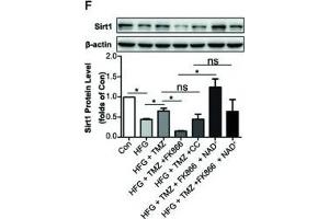 Trimetazidine (TMZ) upregulated Sirt1 expression depending on Nampt/NAD+ pathway in diabetic nephropathy. (SIRT1 anticorps  (AA 448-747))