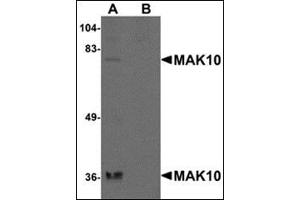 MAK10/NAA35 anticorps  (N-Term)