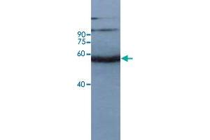 Western blot analysis of rice leaf tissue at seeding stage with Os11g0163600 polyclonal antibody  at 1:10000 dilution. (OS11G0163600 anticorps)