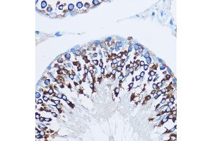Immunohistochemistry of paraffin-embedded rat testis using YB-1/YB-1/YBX1 antibody (ABIN6134494, ABIN6150328, ABIN6150330 and ABIN7101815) at dilution of 1:100 (40x lens).