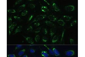 Immunofluorescence analysis of U-2 OS cells using HSD17B10 Polyclonal Antibody at dilution of 1:100 (40x lens).