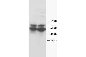 Anti-RUNX2 antibody, Western blotting Lane 1: Rat Thymus Tissue Lysate Lane 2: Rat Testis Tissue Lysate (RUNX2 anticorps  (Middle Region))