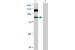 Western Blot analysis of SFMBT1 expression in transfected 293T cell line by SFMBT1 MaxPab polyclonal antibody. (SFMBT1 anticorps  (AA 1-866))