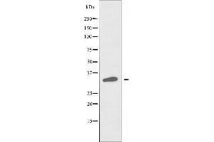 Western blot analysis of extracts from HeLa cells, using CKI-α antibody. (CSNK1A1 anticorps  (Internal Region))