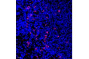 Immunofluorescence of paraffin embedded rat spleen using CD177 (ABIN7073372) at dilution of 1:500 (400x lens)
