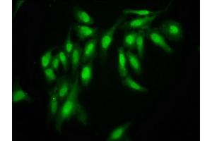 Immunofluorescence staining of Hela cells with ABIN7161246 at 1:166, counter-stained with DAPI.