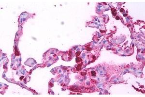 Anti-Macrophages antibody IHC staining of human lung, macrophages. (Macrophages anticorps)