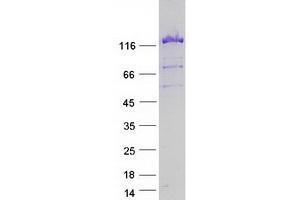 Validation with Western Blot