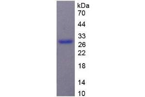 SDS-PAGE (SDS) image for Melanoma Associated Chondroitin Sulfate Proteoglycan (MCSP) (AA 1705-1942) protein (His tag) (ABIN1170940) (NG2 Protein (AA 1705-1942) (His tag))